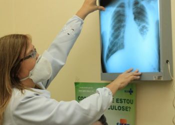 Governo cria comitê para eliminar a tuberculose